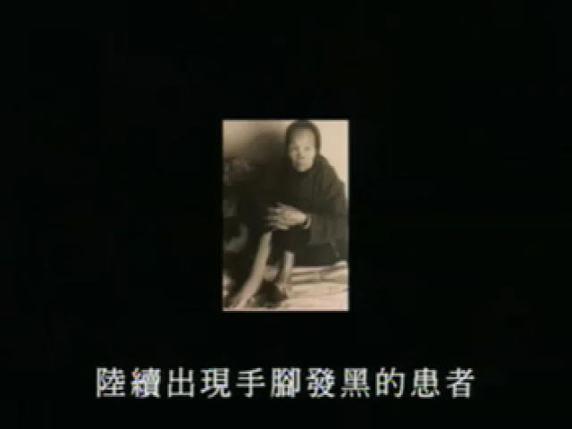 戰疫-台灣流行疾病-4
烏乾蛇：烏腳病