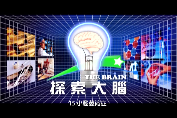 探索大腦.15,小腦萎縮症